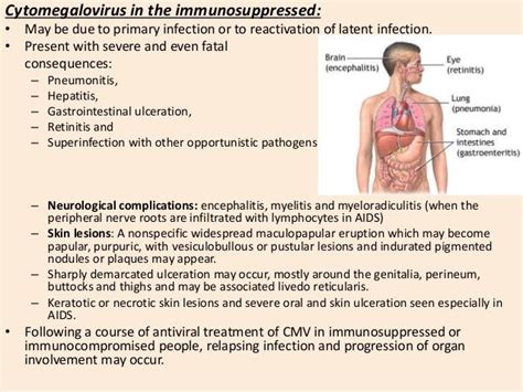 Cytomegalovirus Made Very Easy!