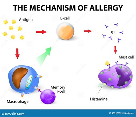 Mechanism Of Allergy Stock Vector - Image: 40397652