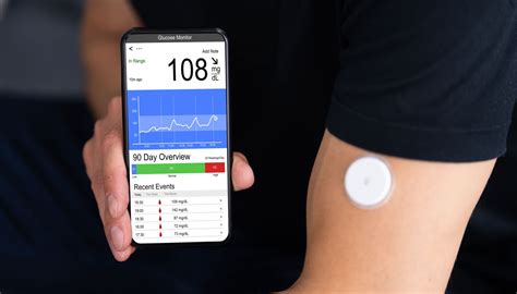 Continuous blood glucose monitors are helpful tracking tool for diabetics - Chicago Sun-Times