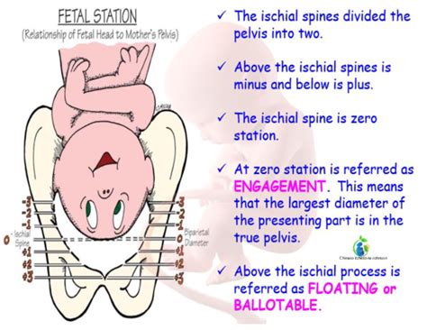 (PDF) Fetal station - CHeat Sheet | Dr. CHINAZO ECHEZONA-JOHNSON - Academia.edu