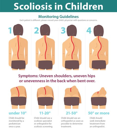 Early Detection of Scoliosis is Critical to Treatment | National ...