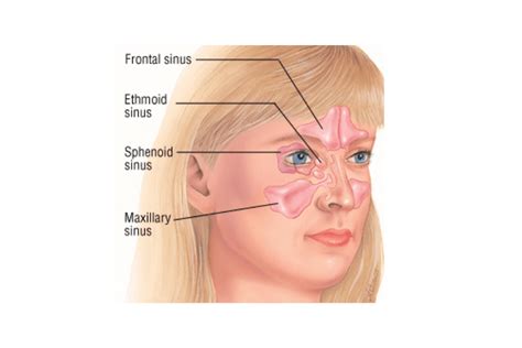 Pressure Points Post Nasal Drip