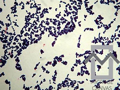 Enterococcus Gram Stain