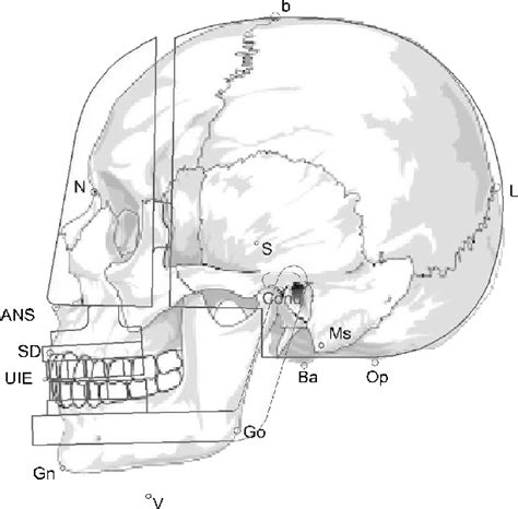 A computer-aided design diagram of the model skull on top of an... | Download Scientific Diagram