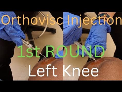 ORTHOVISC INJECTION |1st of 3 rounds|Post Surgery Treatment| Keto ...