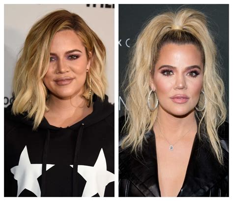 Did Khloé Kardashian Get a Nose Job? Plastic Surgeon Weighs In