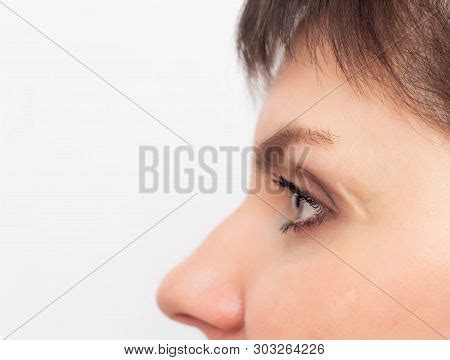 Large Scar Scar On Image & Photo (Free Trial) | Bigstock