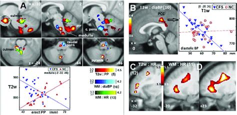 Brainstem vasomotor centre, cerebellum, PCC and prefrontal WM clusters.... | Download Scientific ...