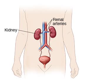 Renal Angiography | Saint Luke's Health System