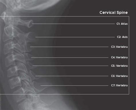 Cervical X Ray