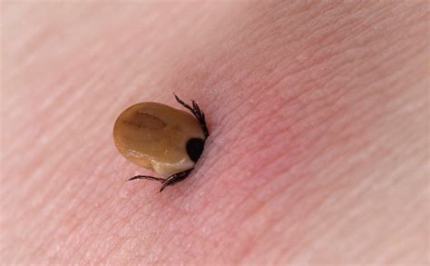 The Usage and Benefits of Home Remedies for Ticks in Yard - Petsepark.com