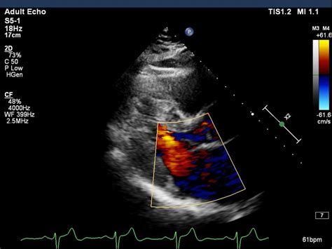 Echocardiography – Sovereign Radiology