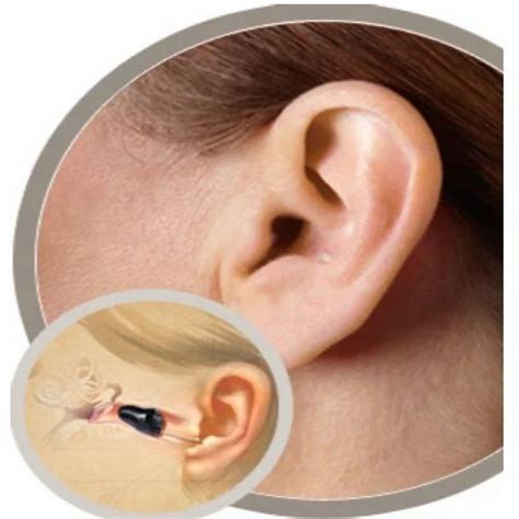 Invisible Hearing Aid at Rs 12000 | Invisible Hearing Devices in Kolkata | ID: 7441821833