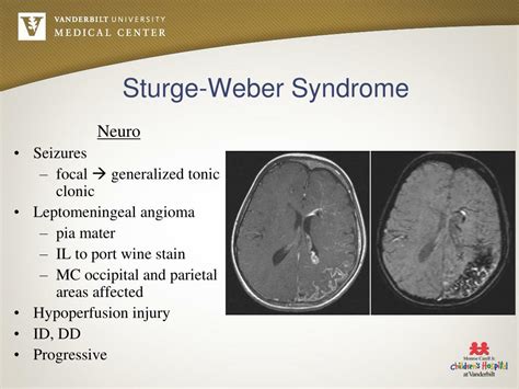 PPT - Neurocutaneous Disorders PowerPoint Presentation, free download - ID:4501574