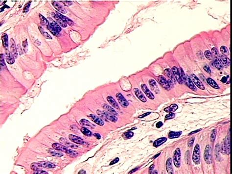 Histology Small Intestine Surface Epithelium Of Simple Columnar And | My XXX Hot Girl