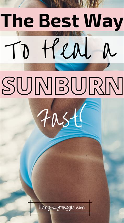 This Is The BEST Way To Treat a Sunburn Fast! in 2024 | Sunburn treatment, Best sunburn ...