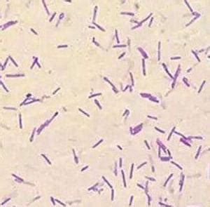 Bacillus Coagulans Gram Stain