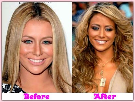 Pictures: Aubrey O’day Plastic Surgery Before and After Breast Implants ...