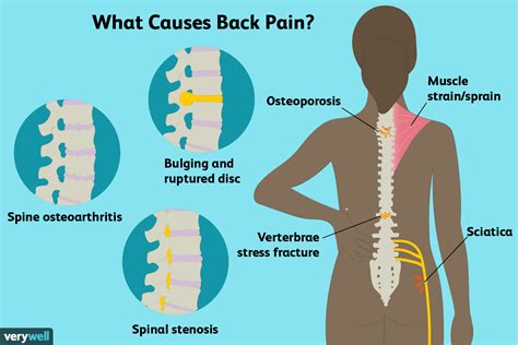 Back Pain: Causes, Treatment, and When to See a Doctor