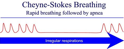 Describe a Normal Rhythm for Respiration