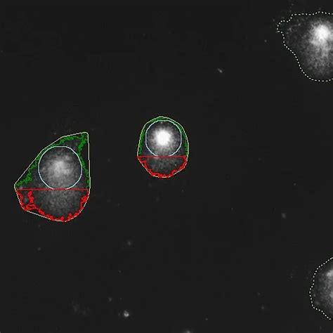 Comet Assay Extension - ADCIS