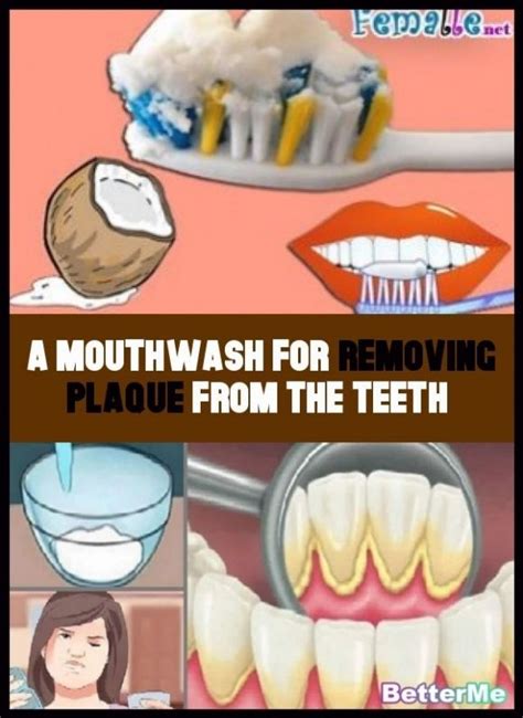 Mouthwash to remove the teeth plaque. in 2020 | Plaque teeth, Mouthwash ...