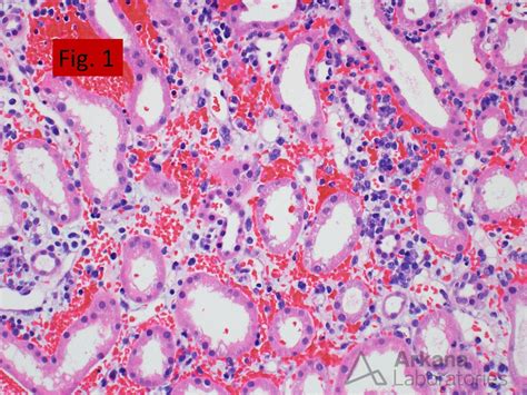 Adenovirus | Teaching Points | Arkana Laboratories