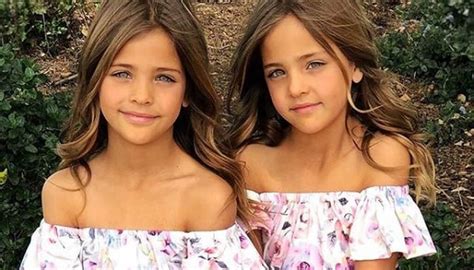 These Twins Were Named “Most Beautiful in The World,” Wait Till You See Them Today ...