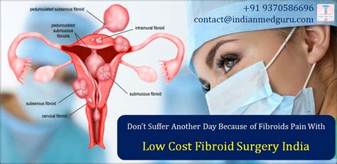 Pin su Fibroid Surgery India