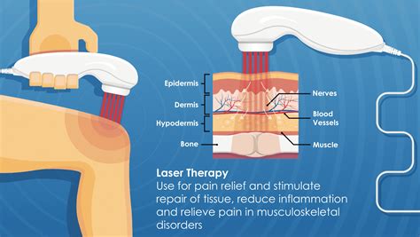 Low Level Laser Therapy