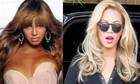 Beyonce Bleached Skin Before And After