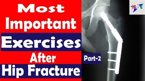 Most Important Exercises After Hip Fracture Part-2 | HEALTH MADE EASY | Hip fracture, Exercise ...