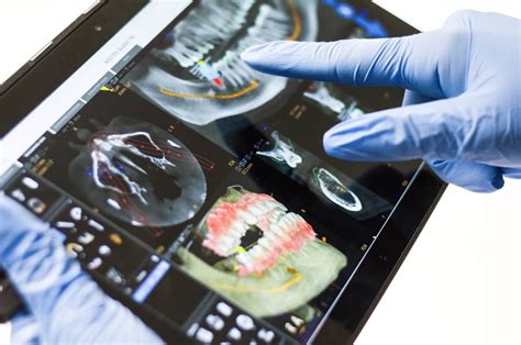 How Dentists Use MRI and CT Scans Systems To Serve Their Patients ...