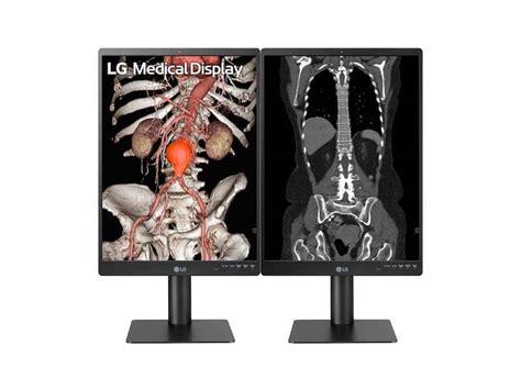 LG Debuts DIGITAL X-RAY DETECTOR, DIAGNOSTIC MONITOR - Axis Imaging News