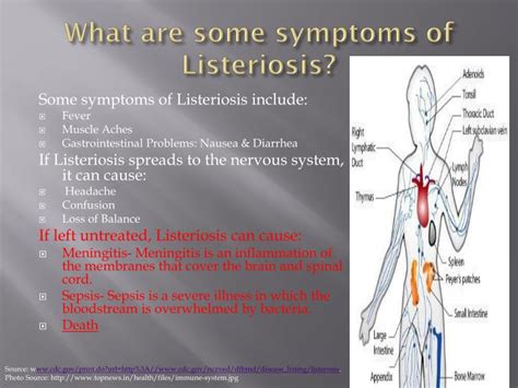 Listeria Symptoms / listeria symptoms | postalda - Kwon Thdow1984