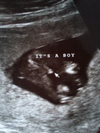 early gender ultrasound! - BabyCenter