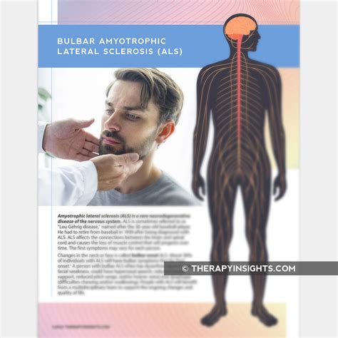 Bulbar Amyotrophic Lateral Sclerosis (ALS) – Adult and pediatric ...