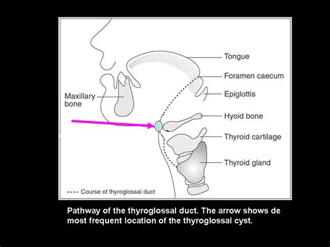 Thyroglossal Duct Embryology