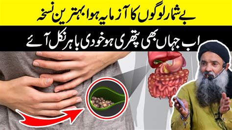 Kidney Stone Pain Relief | Kidney Stone Treatment | Pathri Ka ilaaj Kya Hai Urdu Dr Sharafat Ali ...