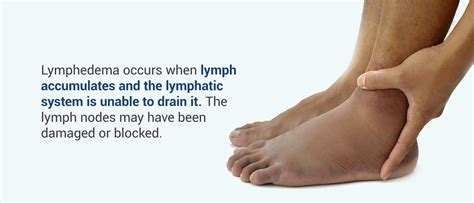 Primary vs. Secondary Lymphedema: Symptoms, Causes and Treatment