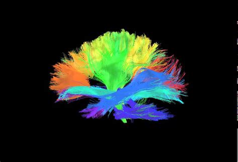 Human Brain Tractography - YouTube