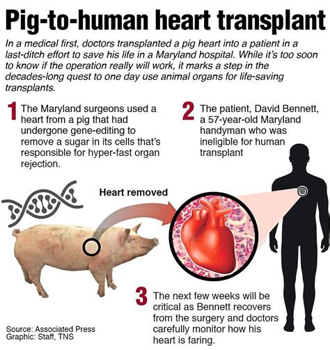 Germans to do pig-to-human heart transplants in two years | The Star