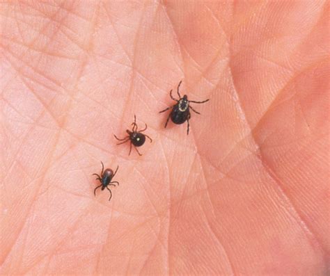 Alpha-Gal Syndrome: What Is the Incurable Meat Allergy Spread by Ticks ...