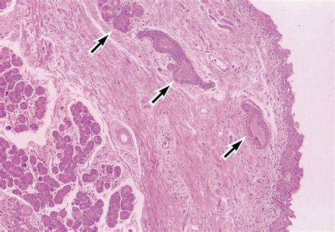 Normal histology of the human lacrimal gland. The lobule has many acini... | Download Scientific ...