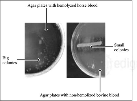 Comparación de dos cultivos en agar Columbia sin NAD al tercer día de... | Download Scientific ...