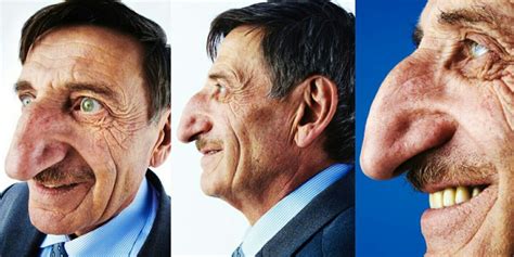 Check out photos of the man with the longest Nose in the world ...