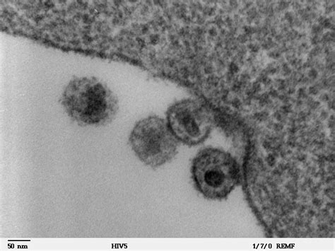 Scientific Image - HIV-infected Cells | NISE Network