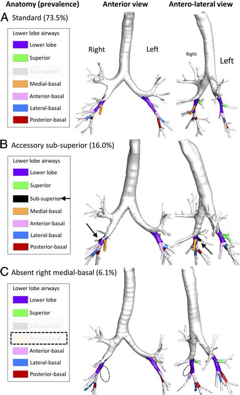 Lower Airway Anatomy - Anatomy Reading Source