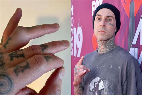 Travis Barker Shares Photos of Injured Finger Ahead of Surgery