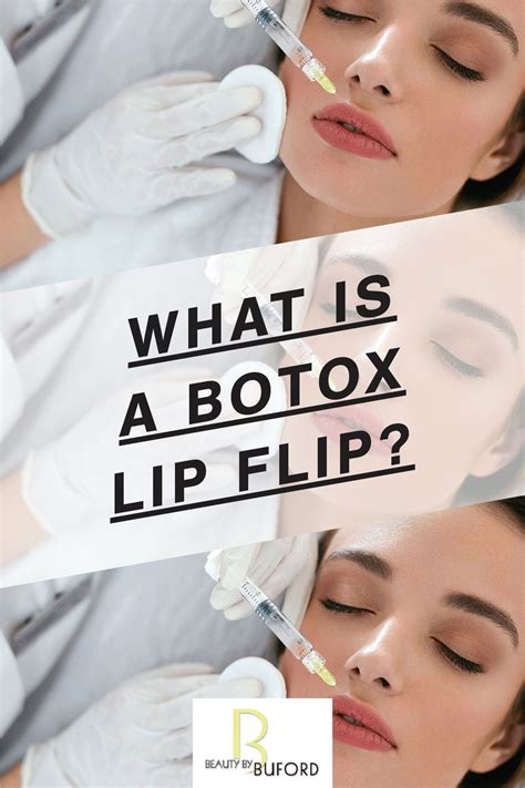 What is a BOTOX Lip Flip? | Estética facial, Facial, Estética